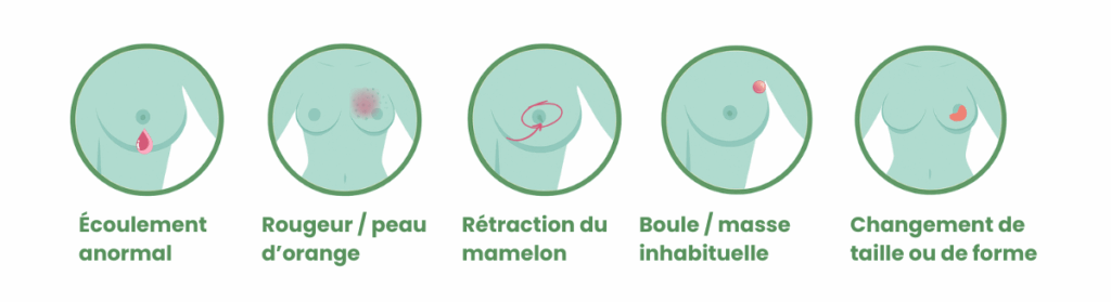 cancer du sein signes alerte